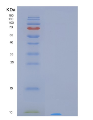 Recombinant Human MT3 Protein,Recombinant Human MT3 Protein