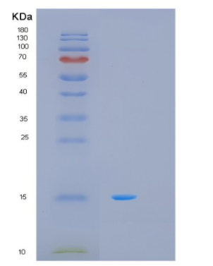 Recombinant Human MTCP1 Protein,Recombinant Human MTCP1 Protein