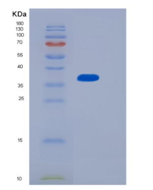 Recombinant Human MTHFD2 Protein,Recombinant Human MTHFD2 Protein