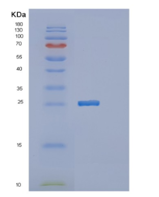 Recombinant Human MTHFS Protein,Recombinant Human MTHFS Protein