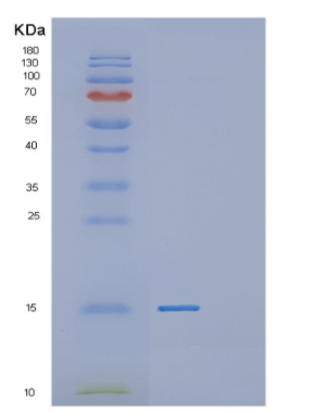 Recombinant Human MTPN Protein,Recombinant Human MTPN Protein