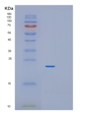 Recombinant Mouse MUP1 Protein,Recombinant Mouse MUP1 Protein