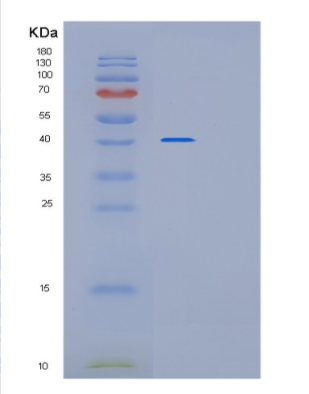 Recombinant E.coli mutY Protein,Recombinant E.coli mutY Protein