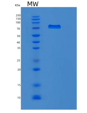 Recombinant Human MX1 Protein,Recombinant Human MX1 Protein