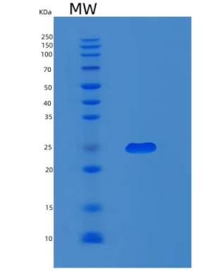 Recombinant Human MXD3 Protein,Recombinant Human MXD3 Protein