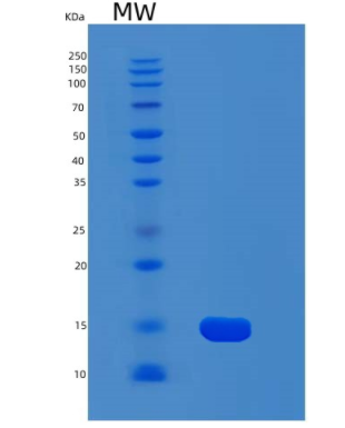 Recombinant Human MYCBP Protein,Recombinant Human MYCBP Protein