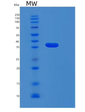 Recombinant Human MYD88 Protein,Recombinant Human MYD88 Protein