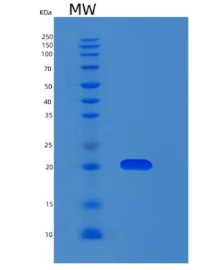 Recombinant Human MYL12A Protein,Recombinant Human MYL12A Protein