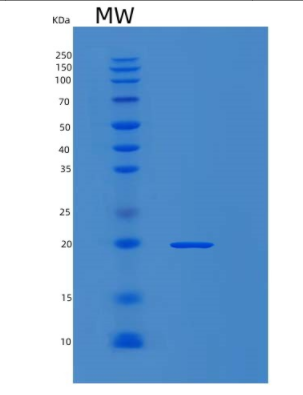 Recombinant Human MYL2 Protein,Recombinant Human MYL2 Protein