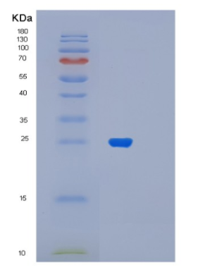 Recombinant Human MYL6B Protein,Recombinant Human MYL6B Protein