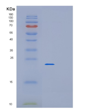 Recombinant Human MYL9 Protein,Recombinant Human MYL9 Protein