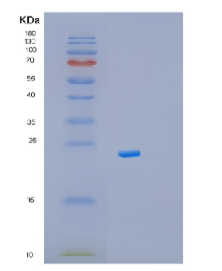 Recombinant Mouse Myl9 Protein,Recombinant Mouse Myl9 Protein