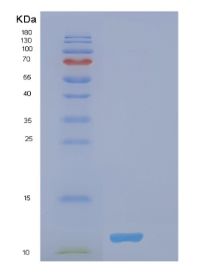 Recombinant Human MZB1 Protein,Recombinant Human MZB1 Protein