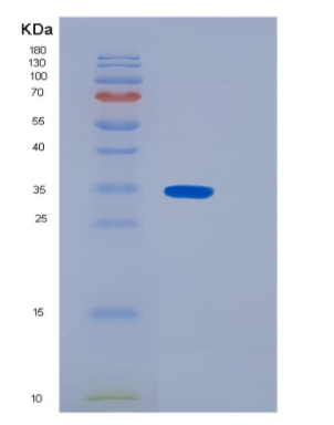 Recombinant Human N-acetyltransferase 6 Protein,Recombinant Human N-acetyltransferase 6 Protein