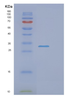 Recombinant Human NAA10 Protein,Recombinant Human NAA10 Protein