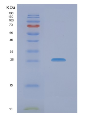 Recombinant Human NACA Protein,Recombinant Human NACA Protein