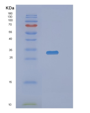 Recombinant Human NANP Protein,Recombinant Human NANP Protein