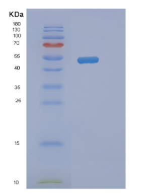 Recombinant Human NAP1L4 Protein,Recombinant Human NAP1L4 Protein