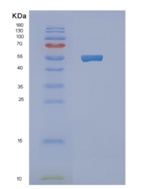 Recombinant Human NBC1 Protein,Recombinant Human NBC1 Protein
