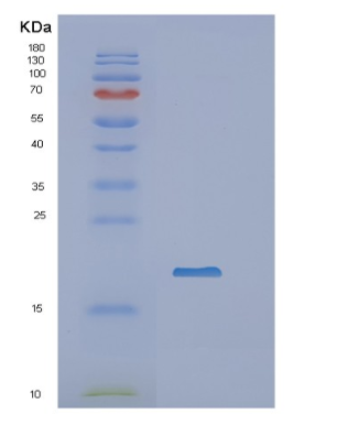 Recombinant Human NCBP2 Protein,Recombinant Human NCBP2 Protein