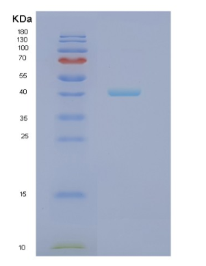 Recombinant Human NCF4 Protein,Recombinant Human NCF4 Protein