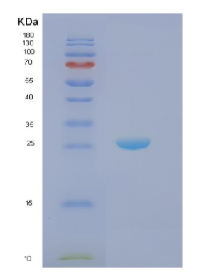 Recombinant Human NCR Protein,Recombinant Human NCR Protein