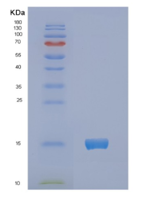 Recombinant Human NCR3 Protein,Recombinant Human NCR3 Protein