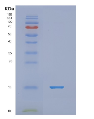 Recombinant Human NDP Protein,Recombinant Human NDP Protein