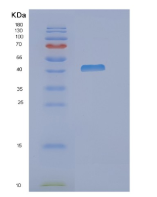 Recombinant Human NDRG3 Protein,Recombinant Human NDRG3 Protein