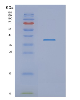 Recombinant Human NDUFAF1 Protein,Recombinant Human NDUFAF1 Protein