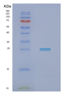 Recombinant Human NDUFV2 Protein,Recombinant Human NDUFV2 Protein