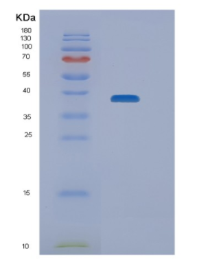 Recombinant Human NEIL2 Protein,Recombinant Human NEIL2 Protein