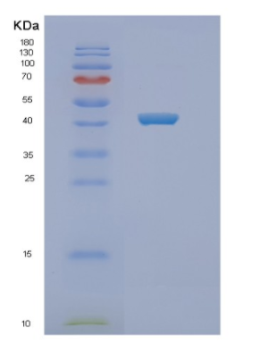 Recombinant Human NEU1 Protein,Recombinant Human NEU1 Protein