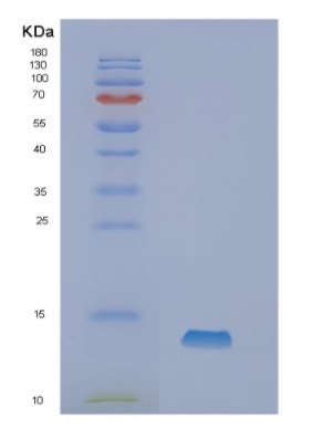 Recombinant Human Neurokinin B Protein,Recombinant Human Neurokinin B Protein