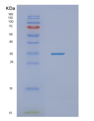 Recombinant Human NFKBID Protein,Recombinant Human NFKBID Protein