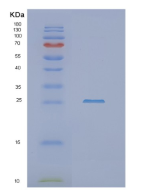 Recombinant Human NHEJ1 Protein,Recombinant Human NHEJ1 Protein