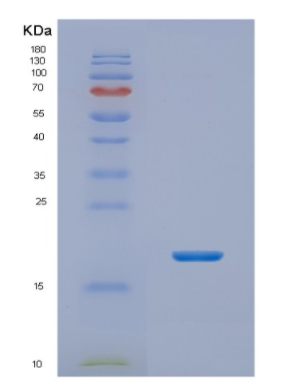 Recombinant Human NHP2 Protein,Recombinant Human NHP2 Protein