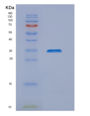 Recombinant Human NIPSNAP1 Protein,Recombinant Human NIPSNAP1 Protein