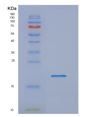 Recombinant Human NME1 Protein,Recombinant Human NME1 Protein