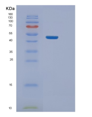 Recombinant Human NELFE Protein,Recombinant Human NELFE Protein