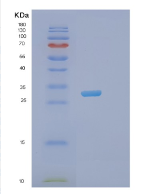 Recombinant Human N-terminal Xaa-Pro-Lys N-methyltransferase1 isoform a Protein,Recombinant Human N-terminal Xaa-Pro-Lys N-methyltransferase1 isoform a Protein