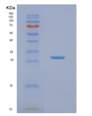 Recombinant Human NABP1 Protein,Recombinant Human NABP1 Protein