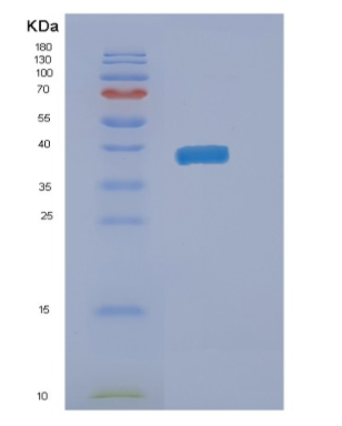 Recombinant Human NAIF1 Protein,Recombinant Human NAIF1 Protein