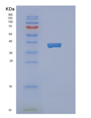 Recombinant Human NAPG Protein,Recombinant Human NAPG Protein