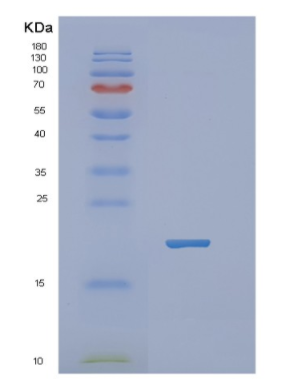 Recombinant Human NBL1 Protein,Recombinant Human NBL1 Protein