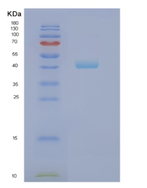 Recombinant Human NCF1 Protein,Recombinant Human NCF1 Protein