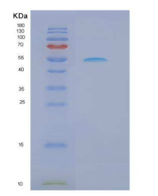 Recombinant Mouse Ncr1 Protein,Recombinant Mouse Ncr1 Protein