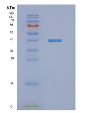 Recombinant Human NDE1 Protein,Recombinant Human NDE1 Protein