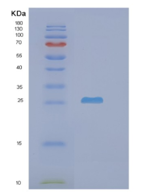 Recombinant Human N6AMT1 Protein,Recombinant Human N6AMT1 Protein