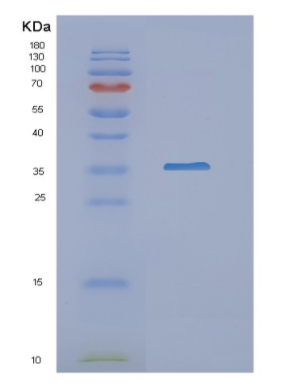 Recombinant Human NAT1 Protein,Recombinant Human NAT1 Protein